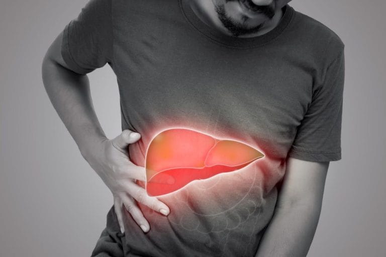 Ciroza hepatică