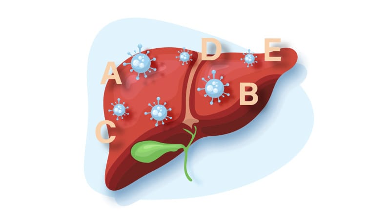 Hepatita virală A, B, C, D, E: Simptome, Tratament și Prevenție Hepatita virală (A, B, C, D, E)